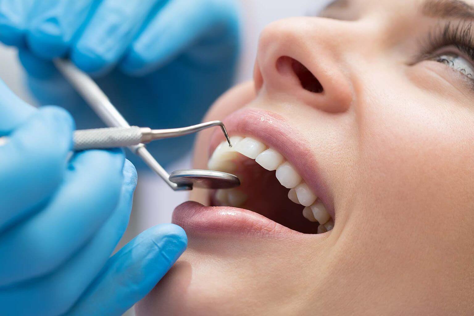Dental Bonding Peachtree City GA