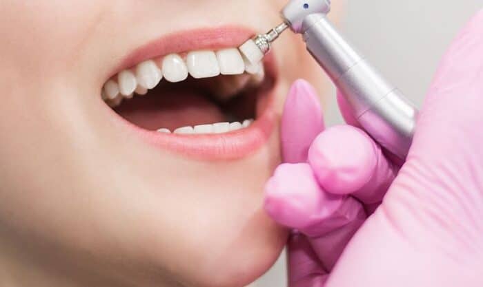 Teeth whitening Peachtree City