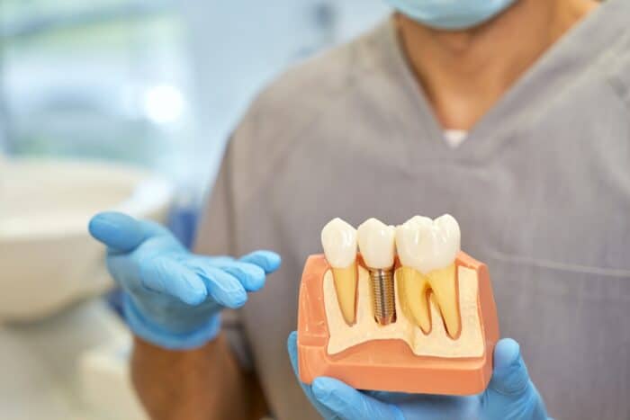 dental implants Peachtree City