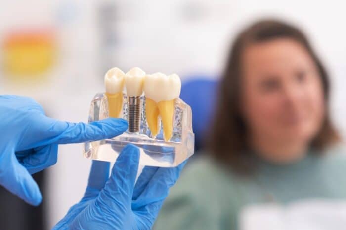 Dental Implants Peachtree City