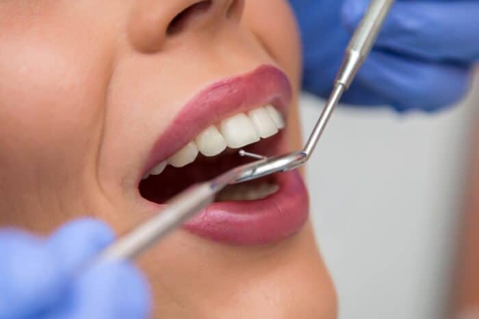 Tooth Extraction Peachtree City