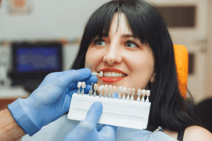 dental veneers by cosmetic dentist in Peachtree