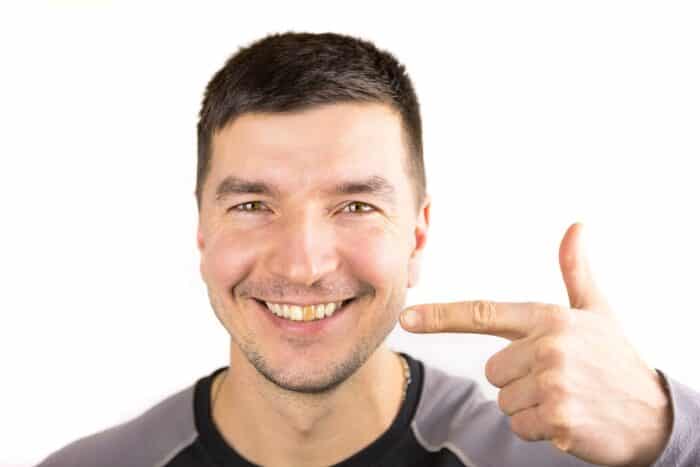 How do you know if you need teeth whitening