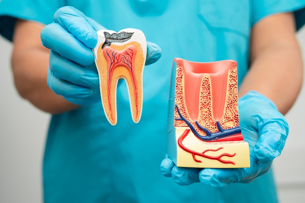 filling vs root canal treatment